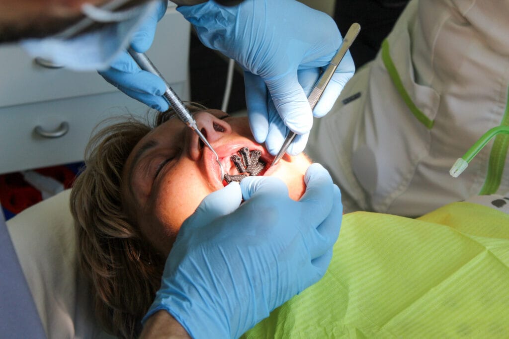 Intraoralna fotogrametrija (IPG)